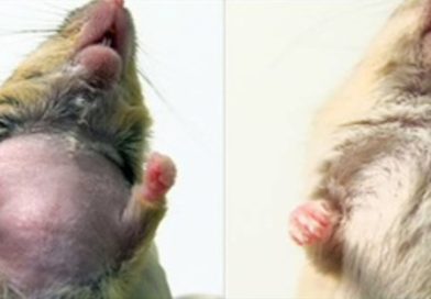 Un trasplante de médula ósea detiene la progresión de la microgliopatía en ratones y humanos