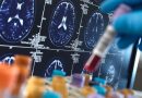 Descubren una alteración en la captación de colesterol neuronal que podría contribuir al Alzheimer