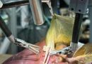 Cirugía hecha sin ayuda humana por un robot con inteligencia artificial
