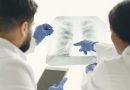 Un nuevo test podría detectar la tuberculosis en minutos al usar un hisopo en la lengua