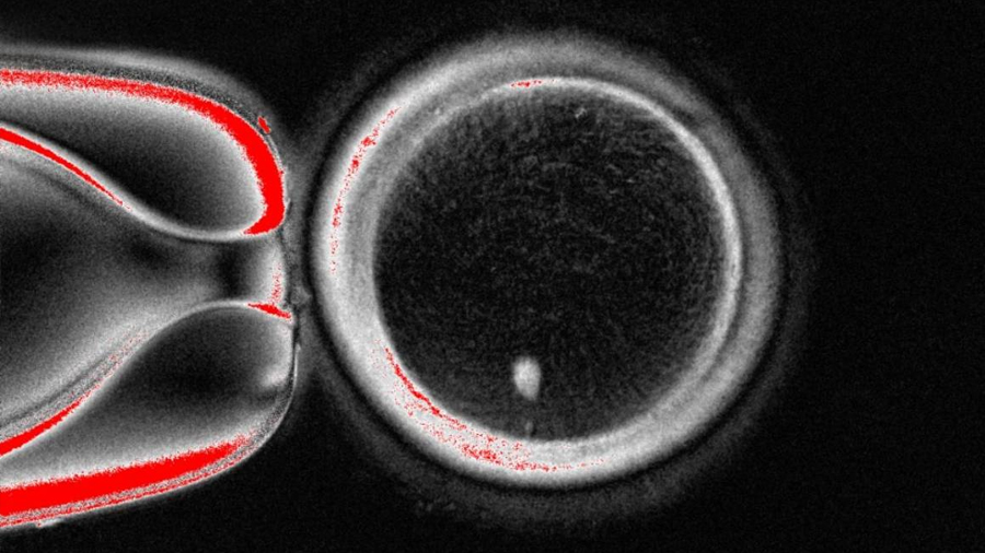 Científicos crean óvulos a partir de células de piel humana