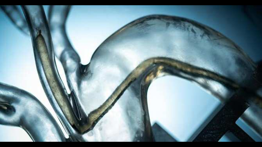 Robot lombriz capaz de circular por el interior del cuerpo humano