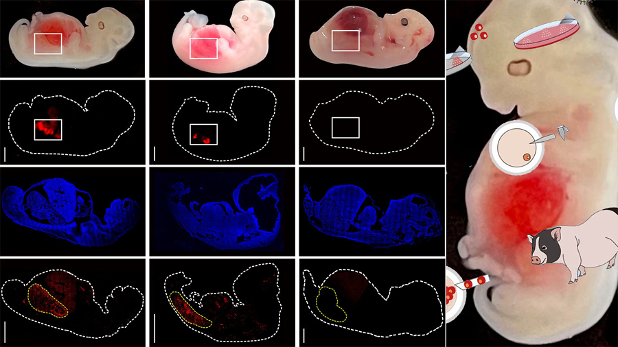 Crean riñones híbridos con células humanas y órganos de cerdo