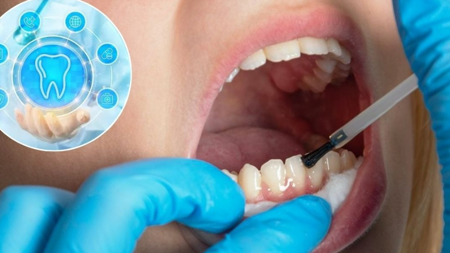 Crean gel que regenera el esmalte dental