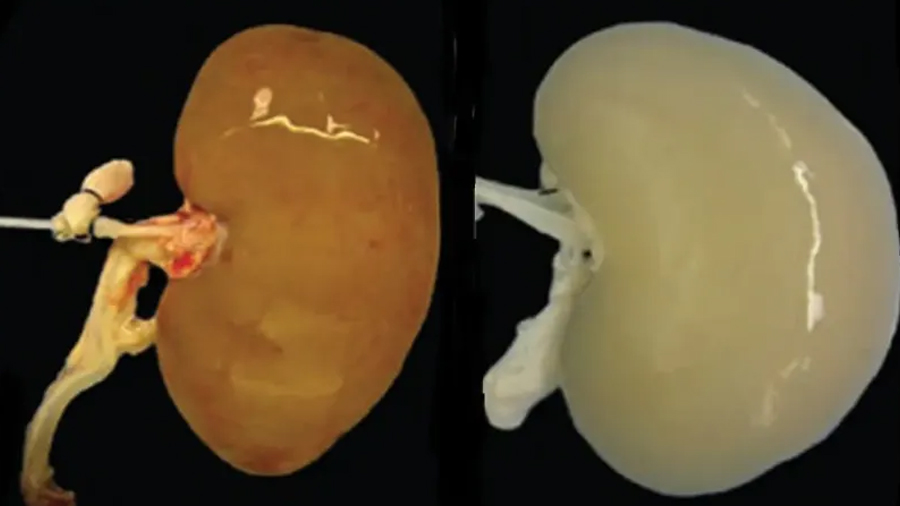 Científicos crean el primer riñón funcional en laboratorio, capaz de producir orina después de un trasplante
