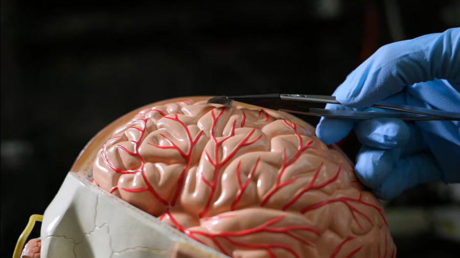 Llegó competencia a Neuralink de Elon Musk: crean un chip que conecta el cerebro a una computadora a través de WiFi