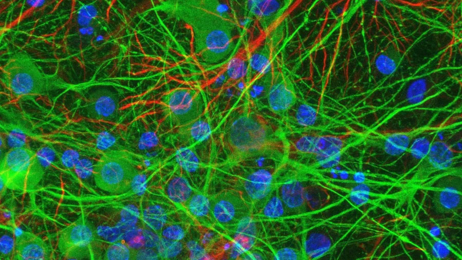 Crean un recubrimiento que perfora bacterias al contacto: podría transformar la lucha contra las bacterias e infecciones hospitalarias