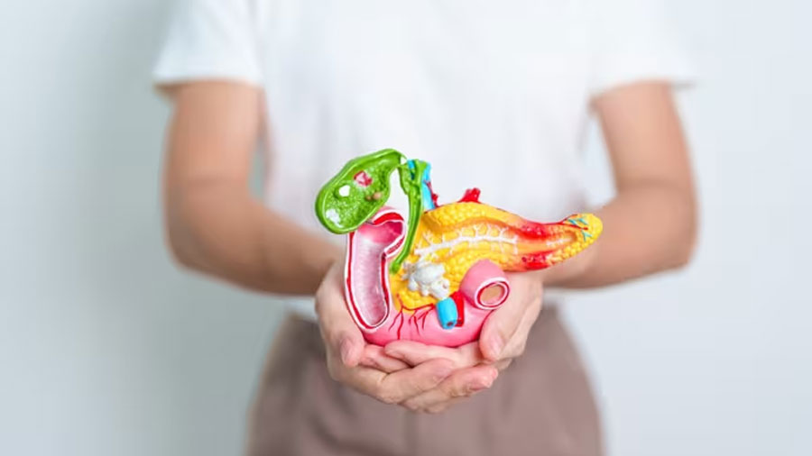 G12R: la mutación KRAS que reduce colágeno y ralentiza la progresión del cáncer pancreático