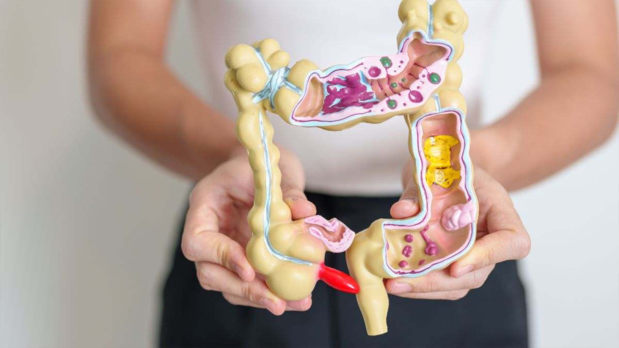 Investigadores españoles descubren un ‘código secreto’ en la sangre que predice el cáncer colorrectal: ‘El resultado es sorprendente’