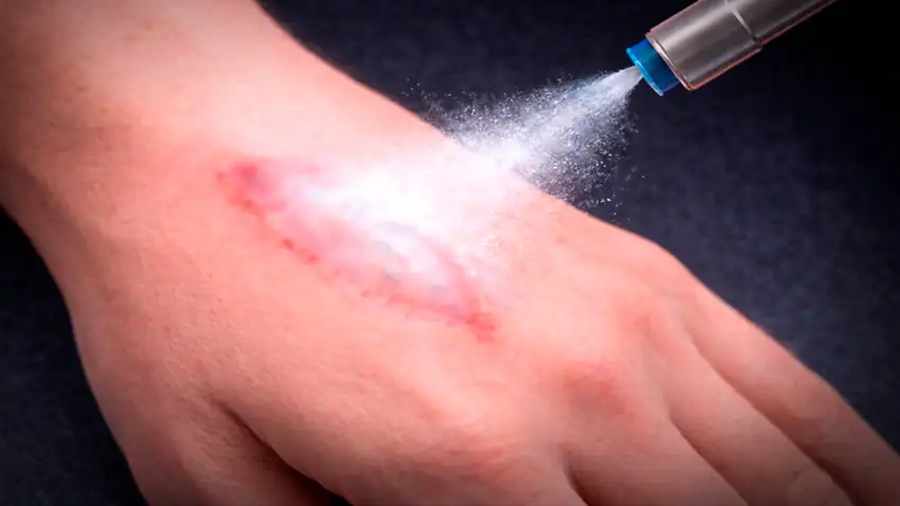 Científicos surcoreanos crean una innovadora sustancia en polvo para detener hemorragias graves solo en segundos