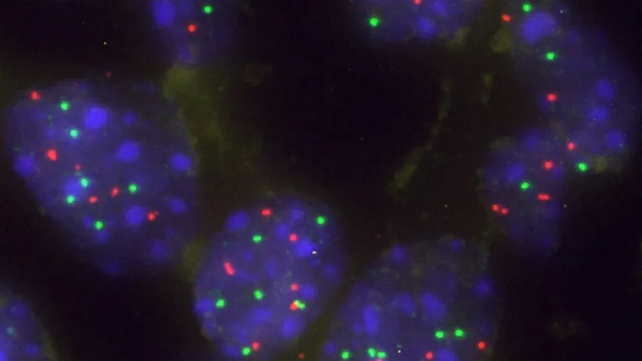 Científicos españoles crean una nueva terapia que ataca y elimina las células tumorales más agresivas