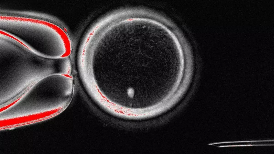 Investigadores de EU crean óvulos humanos a partir de células de la piel, abriendo nuevas vías contra la infertilidad