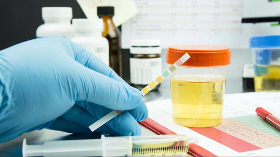 Unos investigadores crean un test capaz de predecir la cantidad de ultraprocesados que consume una persona en un año