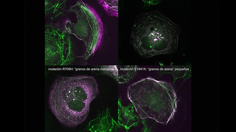 Investigadores de Salamanca descubren cómo mutaciones en un gen dictan la gravedad de enfermedades raras de la sangre