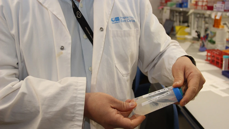 Investigadores españoles crean un hidrogel que logra recuperar la mielina en esclerosis múltiple