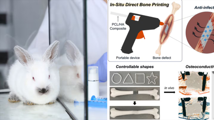 Crean pistola que imprime huesos y que ayudará a crear implantes en vivo en los quirófanos