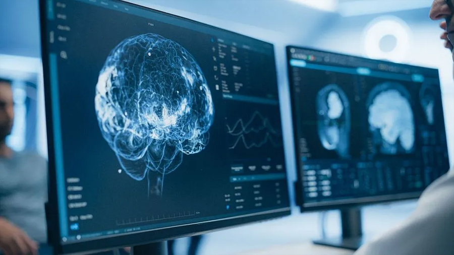 Científicos rusos hallan método eficaz para estimular neuronas cerebrales sin cirugía