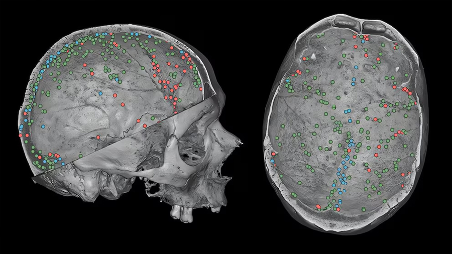 Descubren una red oculta en el cráneo que podría participar en la defensa del cerebro: cómo funciona
