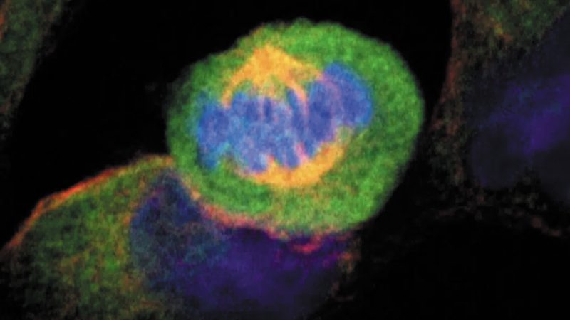 Investigadores descubren que la acidosis en los tejidos ‘altera’ el sistema de transporte de células