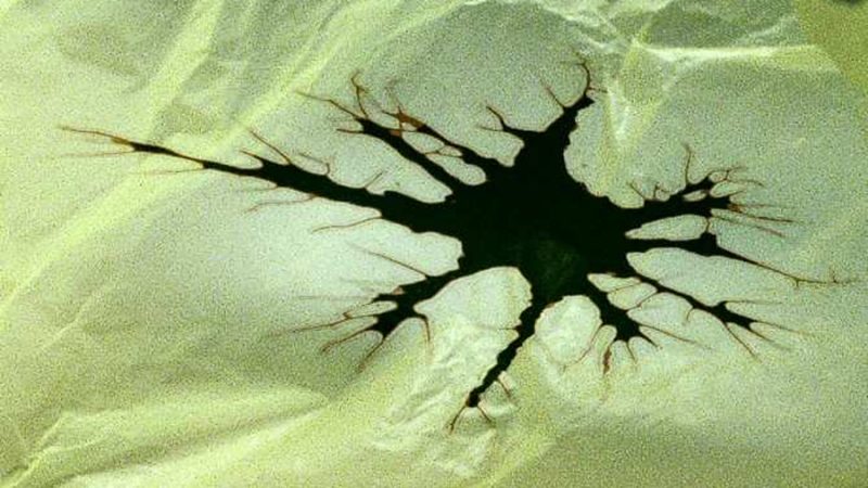 Ictus y demencia por partículas de plástico en el cerebro