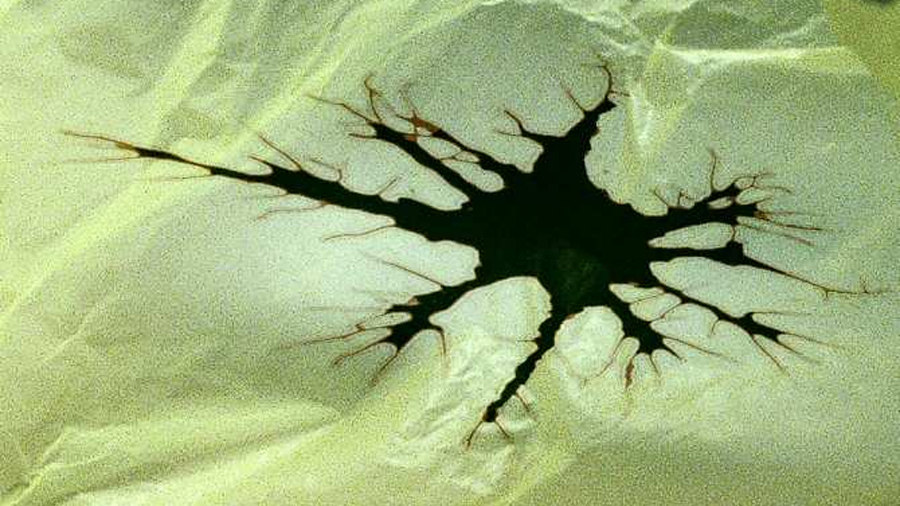 Ictus y demencia por partículas de plástico en el cerebro