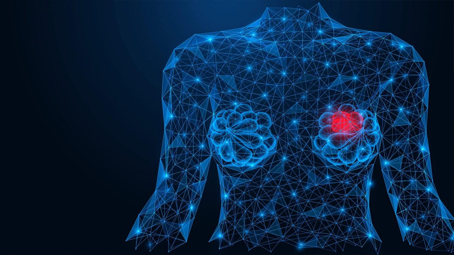 Impulsa la Inteligencia Artificial la detección temprana del cáncer de mama en México