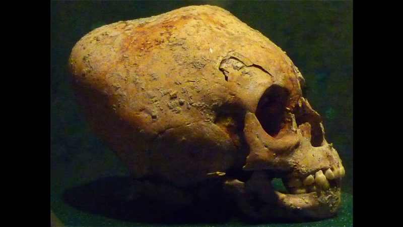 Cráneo con forma cuadrada hallado en México cambia lo que se sabía sobre una antigua práctica mesoamericana