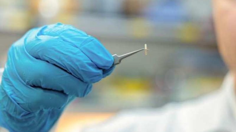 Controlar la actividad de nervios mediante dispositivos intracorporales inyectables