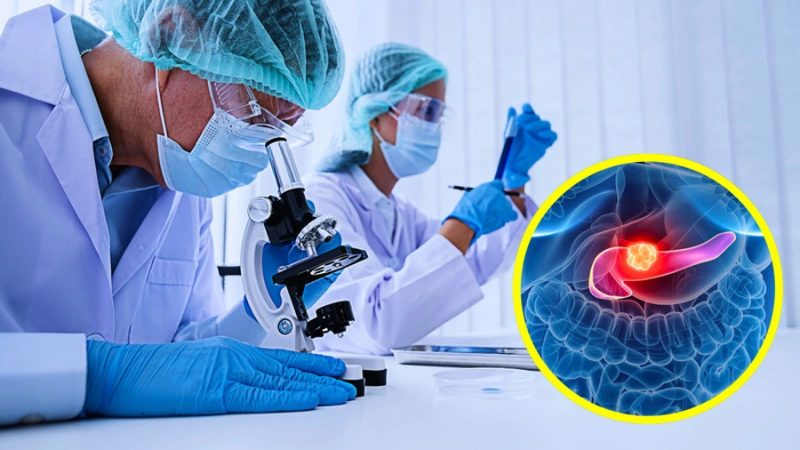 Científicos descubren células clave que podrían revolucionar la detección del cáncer de páncreas
