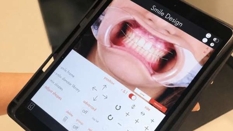 Odontología de precisión: qué aportan el flujo digital y la inteligencia artificial al tratamiento dental