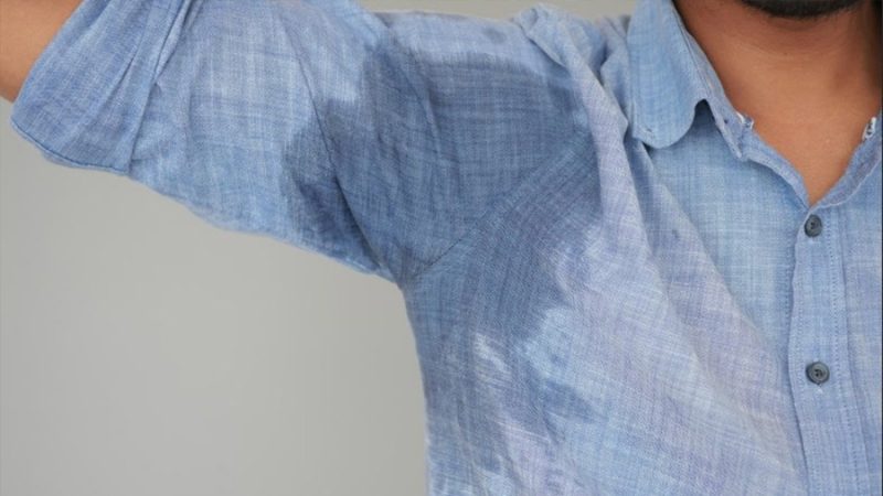 Sudor excesivo en axilas, manos o pies: puede reducirse hasta en un 70% con estas terapias específicas