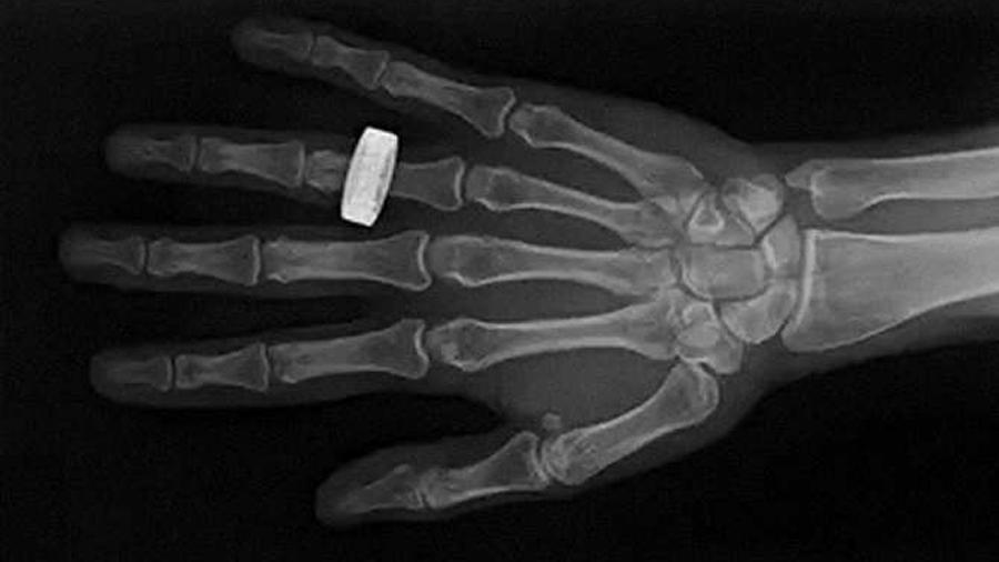 Primeras radiografías médicas hechas en el espacio