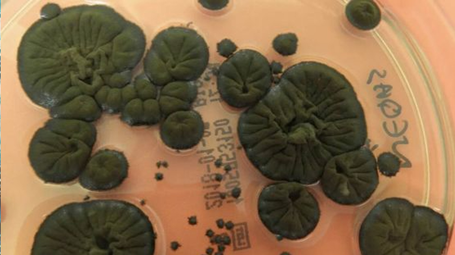 Analizan los hongos negros de Chernóbil y descubren que guardan el secreto para hacer posibles los viajes espaciales