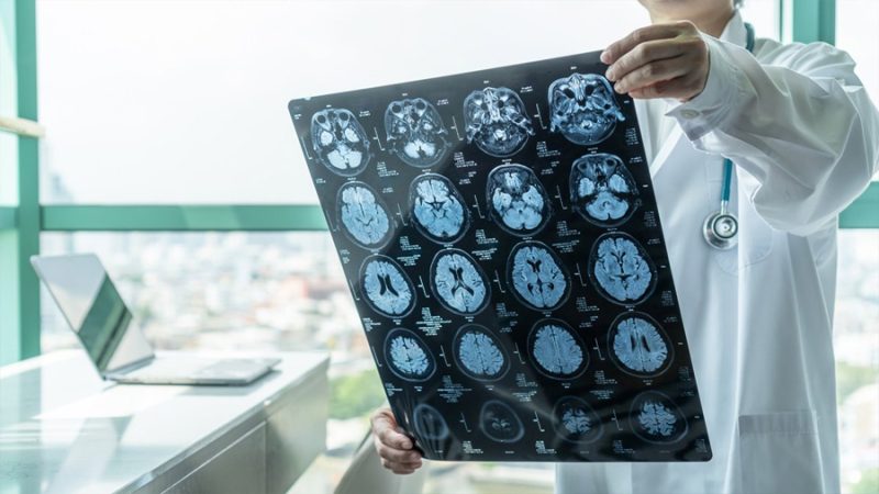 El origen de la neuroinflamación: Hallan la ‘invasión’ de células sanguíneas inflamatorias en el cerebro maduro