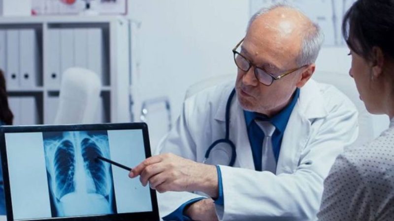Avance en el cáncer de pulmón: un nuevo biomarcador mejora el diagnóstico y el tratamiento