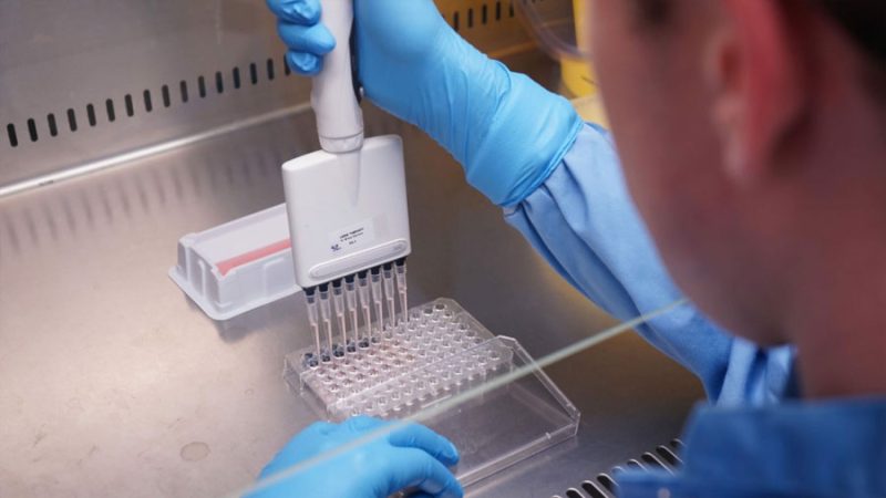 Investigadores de Granada logran eliminar hasta el 97% del VIH en células de laboratorio