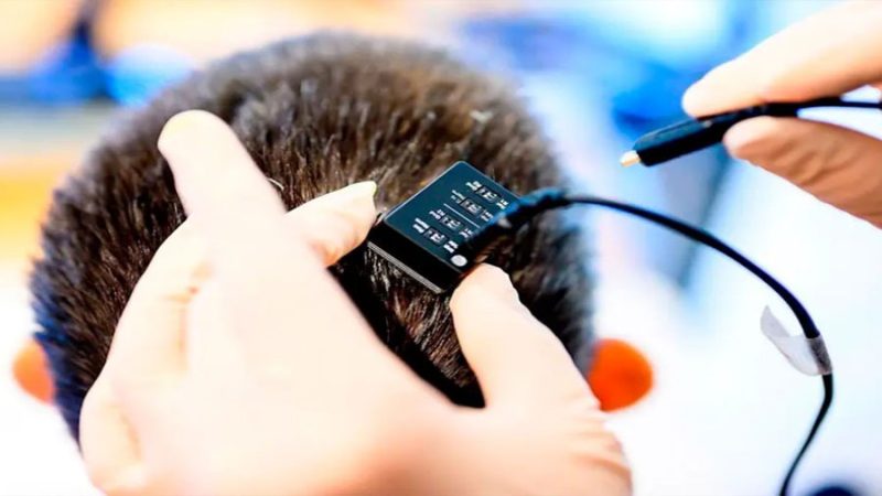 Crean implante inteligente que puede leer y modificar la actividad del cerebro