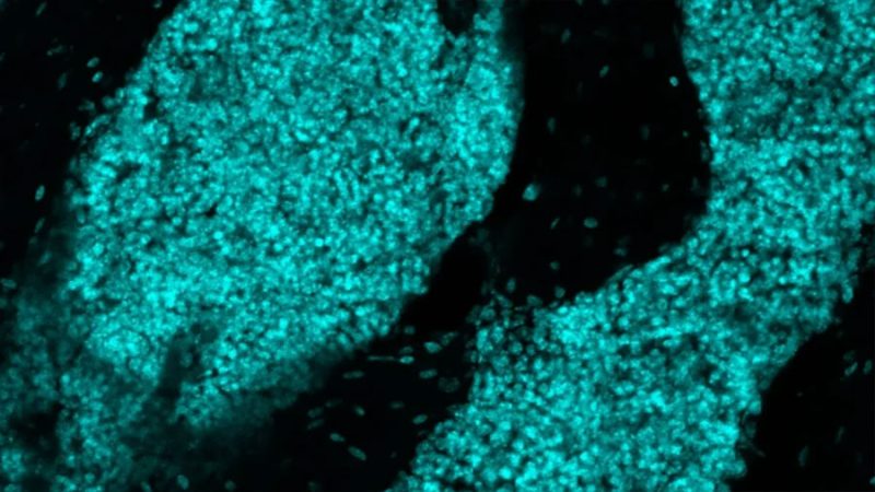 Descubren un sistema inmunitario oculto dentro del cráneo