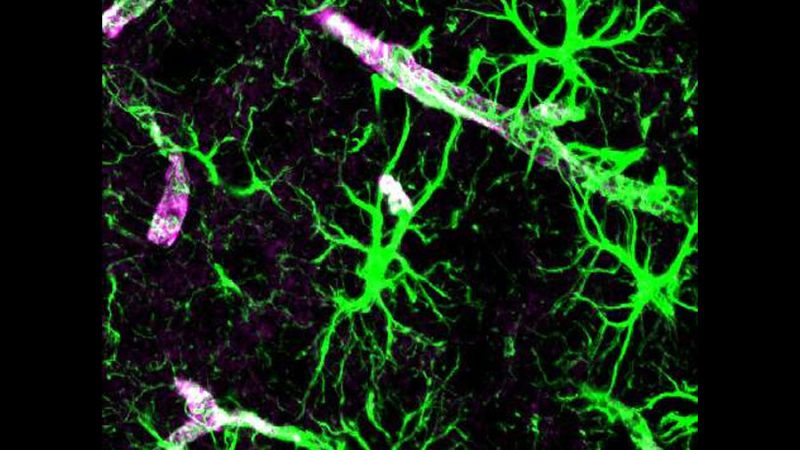 Cómo el cuerpo y el cerebro eliminan la basura metabólica mientras duermes