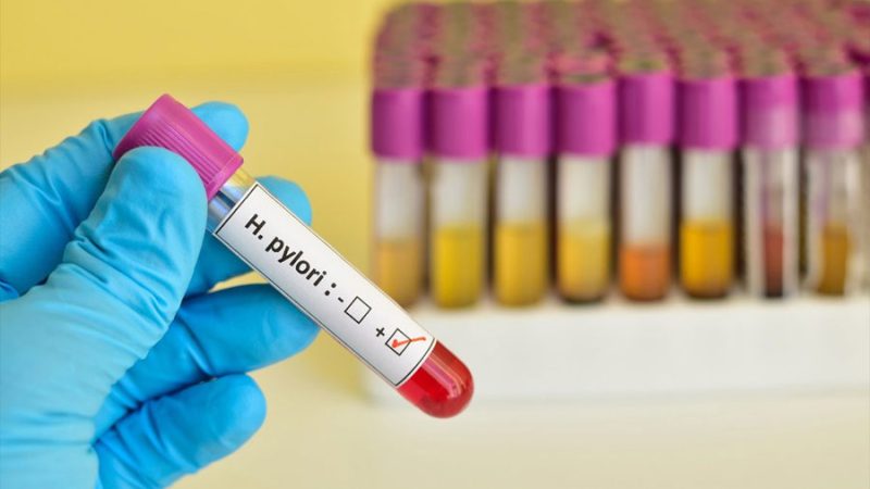 La bacteria del estómago que podría estar detrás de 1 de cada 5 casos de cáncer colorrectal