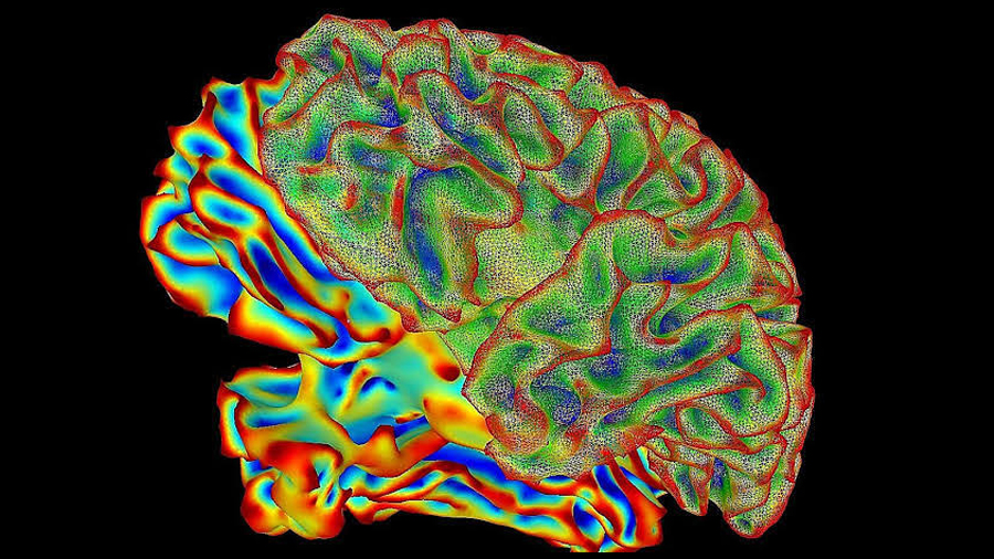 Descubren que el cerebro humano no es un órgano sino dos