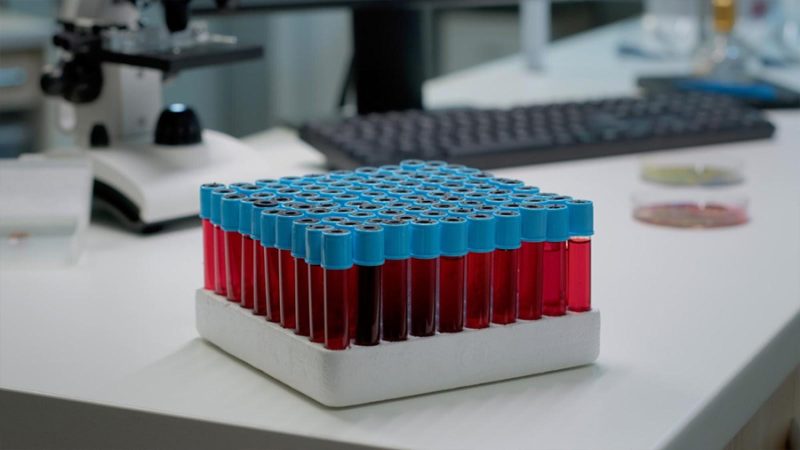 Theranos como advertencia: cuando la narrativa comercial corre más rápido que la ingeniería