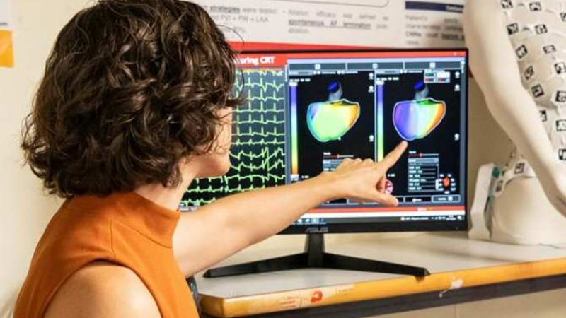 Inteligencia artificial para diagnósticos de cardiomiopatía auricular