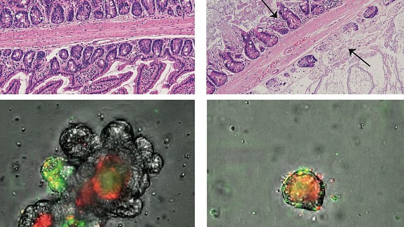 Investigadores de la Universidad de Salamanca descubren qué ocurre cuando el intestino pierde su barrera protectora